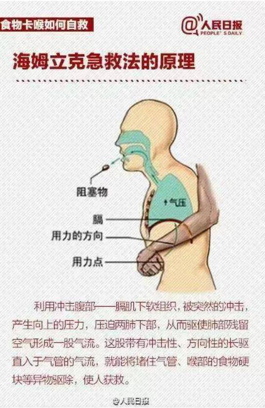 异物卡住气管 家人努力无果！多亏遇到了这位大学生 (图4)