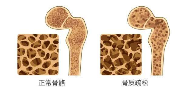 维生素D补到几岁？专家：全生命周期都要补充 (图1)